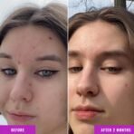 Good Molecules Niacinamide Serum - 10% Niacinamide to Target Blemishes, Nourishment, and Skin Tone - Ultra Hydrating Serum and Brightening Skin Care for Face - Image 5