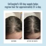 Foundation Skincare UnTangled Hair Vitamins (60-day supply) - Collagen & Biotin Supplement for Women & Men, Visibly Thicker, Faster Hair Growth - Image 6