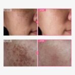 TOSOWOONG Arbutin 7% + Tranexamic Acid 4% Cream, 70,000ppm Arbutin, 40,000ppm TXA, Niacinamide, Glutathione, Dark Spots, Freckle, Blemishes, Pigmentation, Korean Skin Care, 50ml, 1.69 fl.oz. - Image 3