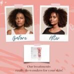 TURBINNE Pure 2.5% Retinol Serum Capsules. Look 5 Years Younger In Just 30 Days. Powerful Anti -Aging, Deep Hydration, Brightening, Reduce Wrinkles, Acne Scars, Dark Spots. Complete Skincare Capsules - Image 4