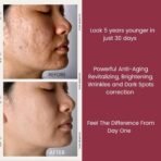 TURBINNE Pure 2.5% Retinol Serum Capsules. Look 5 Years Younger In Just 30 Days. Powerful Anti -Aging, Deep Hydration, Brightening, Reduce Wrinkles, Acne Scars, Dark Spots. Complete Skincare Capsules - Image 9