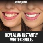 Spotlight Oral Care Teeth Whitening Powder - Made by Dentists | PAP+, Hydroxyapatite & Diamond Powder | Non-Abrasive & Enamel-Safe | Suitable for Sensitive Teeth & Dental Work | Instant Whitening - Image 3